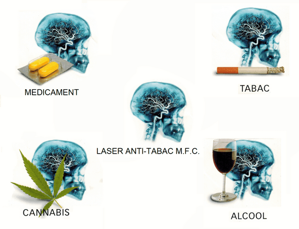 Traitement des addictions par laser avec la méthode MFC