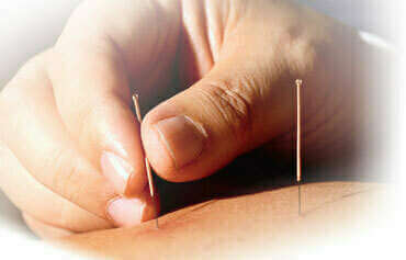 Séance d'acupuncture pour rééquilibrer les énergies du corps